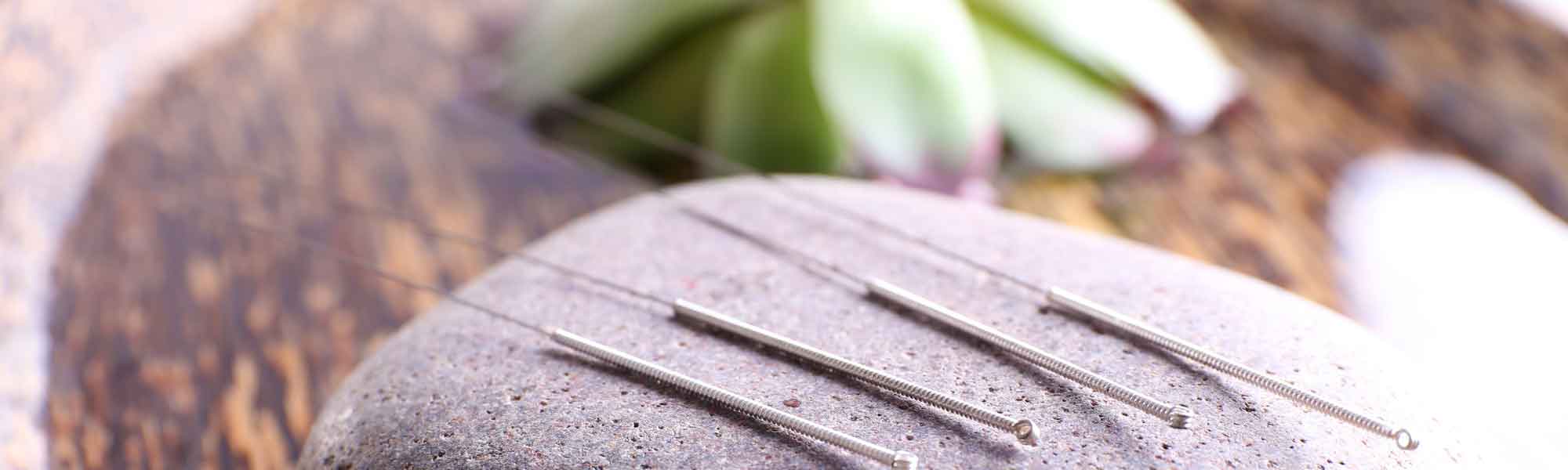 Exploring the Science: Acupuncture and Its Benefits for Fertility