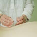 Acupuncture and red light therapy during IVF stimulation at Acupuncture Denver