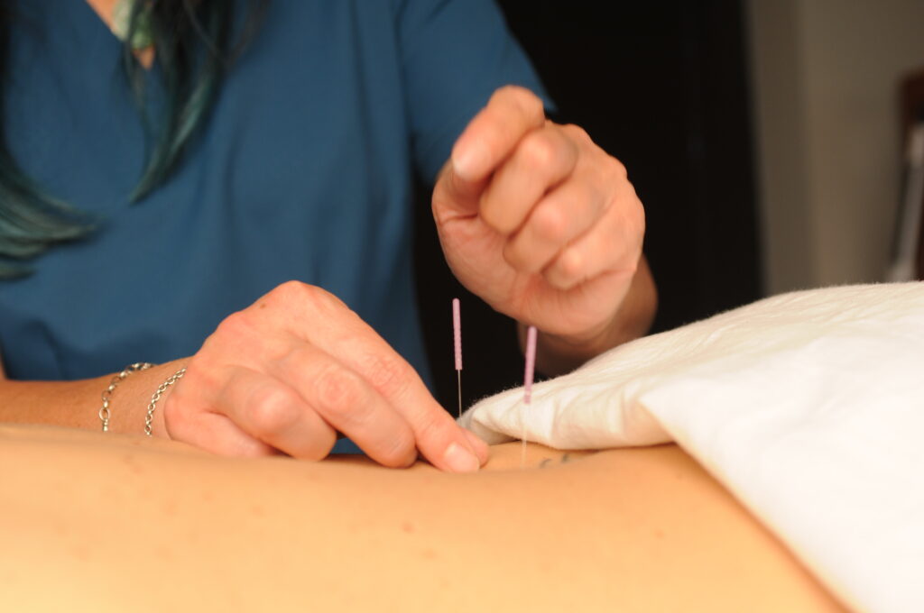 Acupuncture for Egg Quality over 35 in Denver