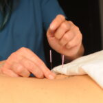 Acupuncture for Egg Quality over 35 in Denver