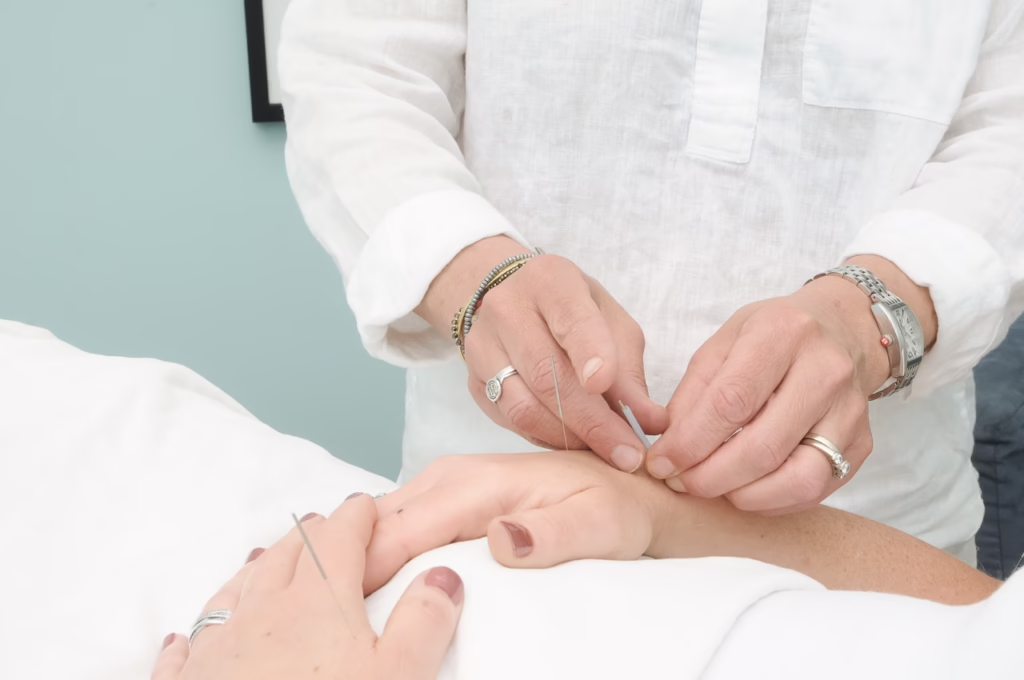 Acupuncture for IUI